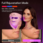 INIA Glow Wireless Red Light Therapy Mask